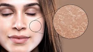 রোজায় ত্বক সজীব ও আর্দ্র রাখতে করণীয়