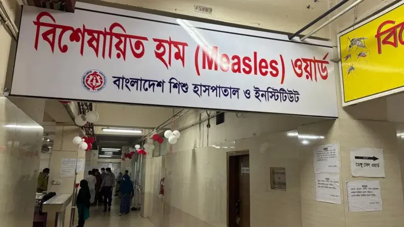হামের উপসর্গে আরও তিন শিশুর মৃত্যু