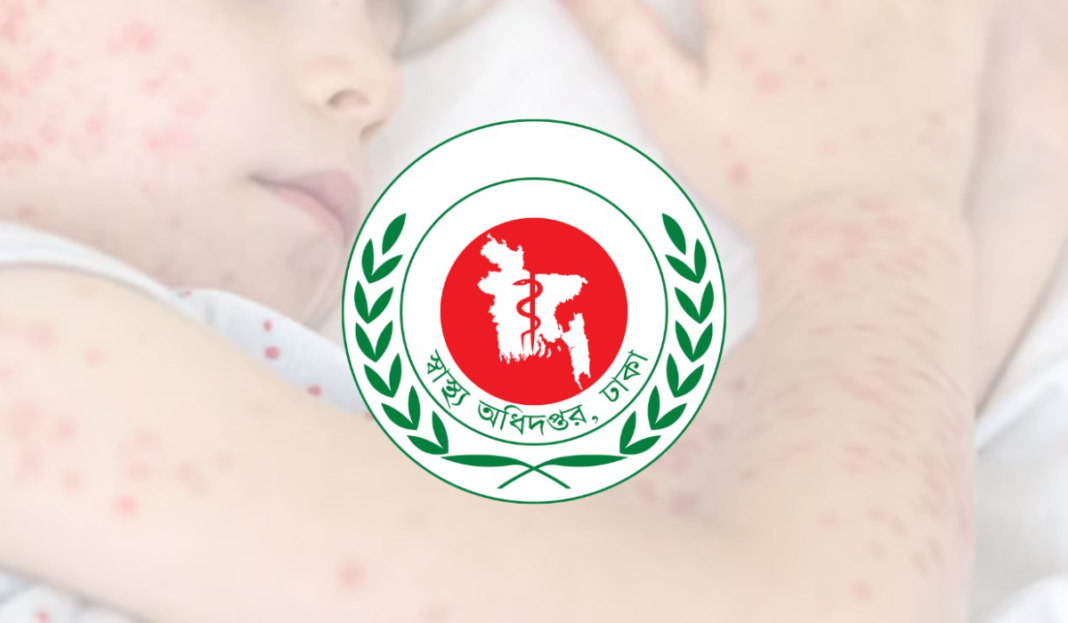 ২৪ ঘণ্টায় হাম উপসর্গে ৭ জনের মৃত্যু, নতুন রোগী ১৩১৯